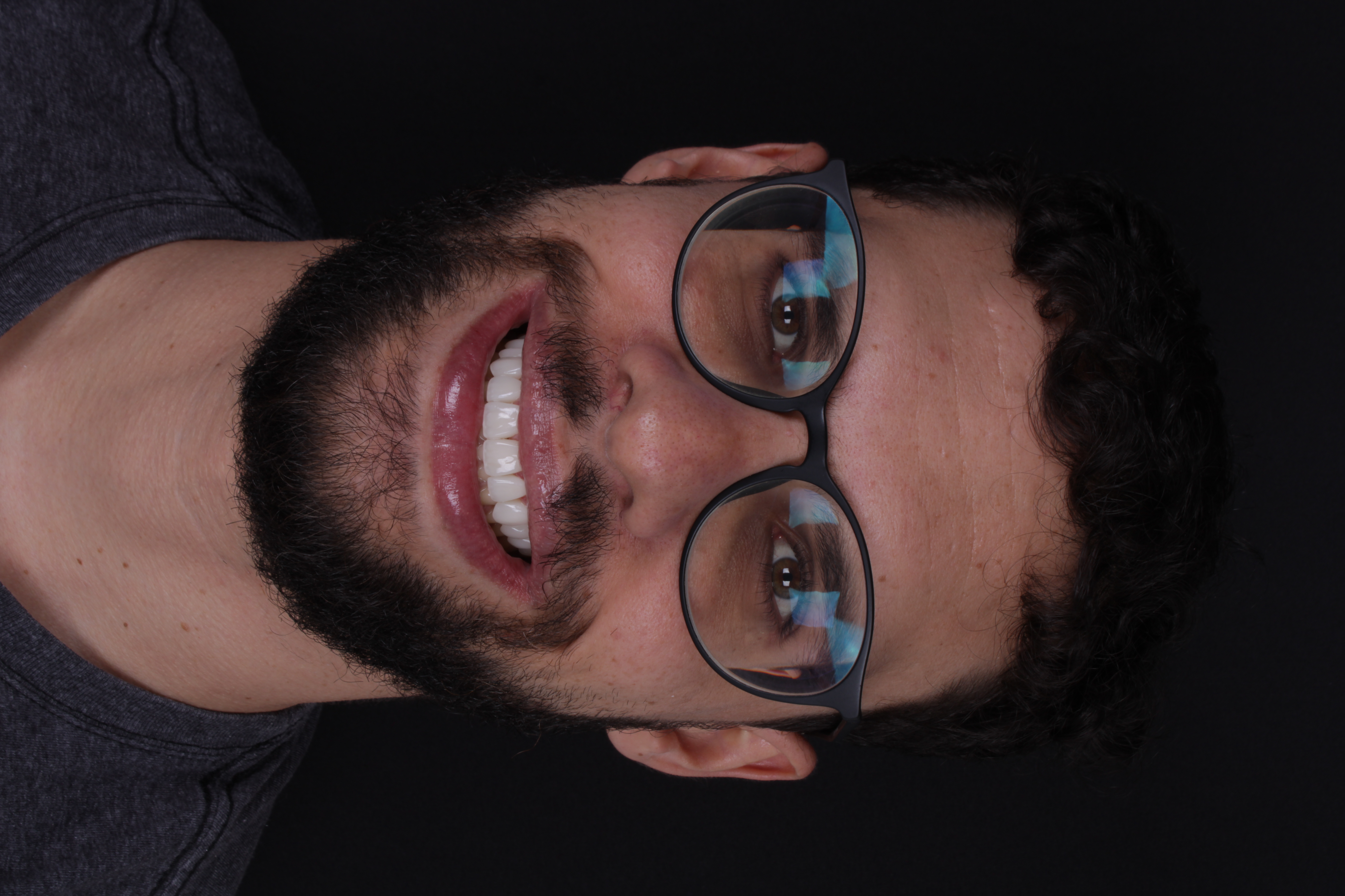 Sorriso transformado